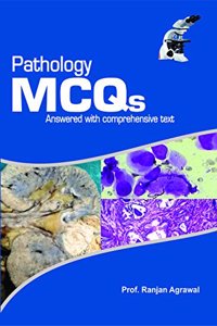 PATHOLOGY MCQs: ANSWERED WITH COMPREHENSIVE TEXT (First Edition, 2013)