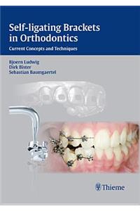 Self-Ligating Brackets in Orthodontics