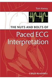 The Nuts and Bolts of Paced ECG Interpretation