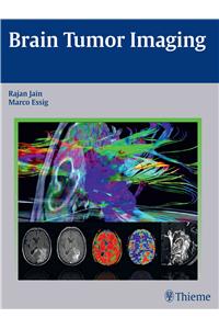 Brain Tumor Imaging