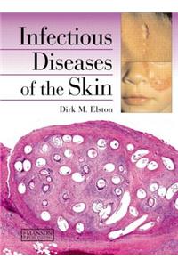 Infectious Diseases of the Skin