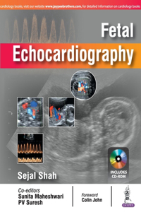 Fetal Echocardiography