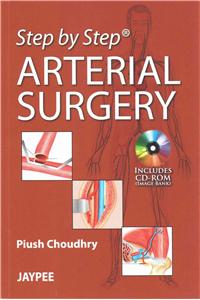 Step by Step: Arterial Surgery