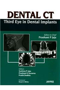 Dental CT Third Eye in Dental Implants