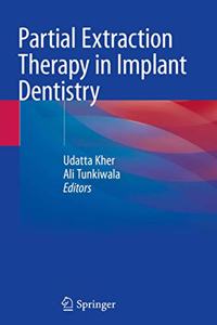 Partial Extraction Therapy in Implant Dentistry