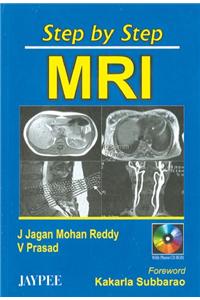 Step by Step MRI with CD-ROM