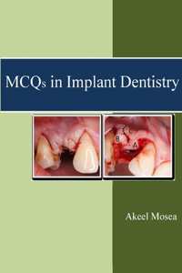 MCQs in Implant Dentistry