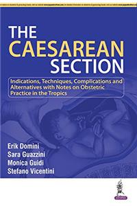 The Caesarean Section