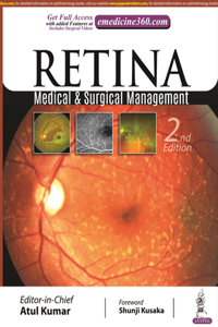 Retina