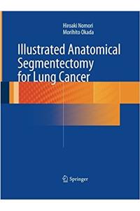 Illustrated Anatomical Segmentectomy for Lung Cancer