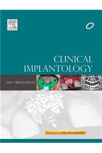 Clinical Implantology; E-Book also available