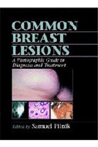 Common Breast Lesions: A Photographic Guide to Diagnosis and Treatment