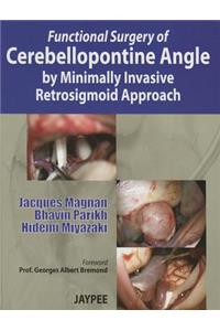 Functional Surgery of Cerebellopontine Angle by Minimally Invasive Retrosigmoid Approach