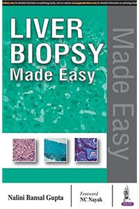 Liver Biopsy Made Easy