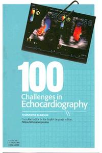 100 Challenges in Echocardiography