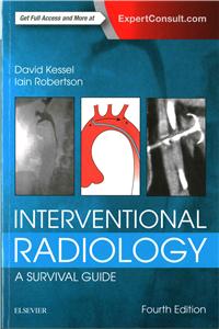 Interventional Radiology: A Survival Guide