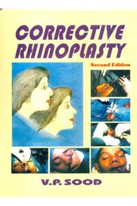 Corrective Rhinoplastry