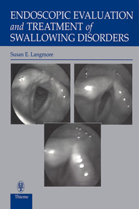 Endoscopic Evaluation and Treatment of Swallowing Disorders