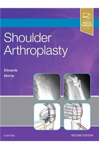 Shoulder Arthroplasty