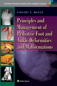 Principles and Management of Pediatric Foot and Ankle Deformities and Malformations