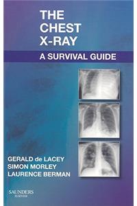 The Chest X-Ray: A Survival Guide