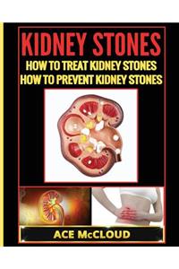 Kidney Stones