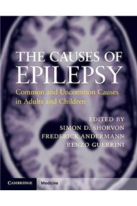 The Causes of Epilepsy: Common and Uncommon Causes in Adults and Children