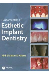 Fundamentals of Esthetic Implant Dentistry