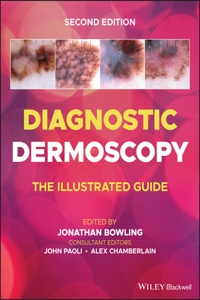 Diagnostic Dermoscopy