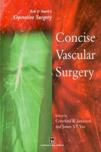 Rob & Smith's Operative Surgery: Concise Vascular Surgery (Rob & Smith's Operative Surgery Series)