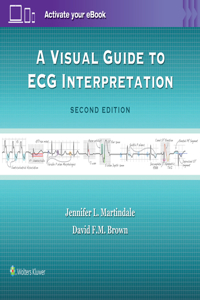 A Visual Guide to ECG Interpretation