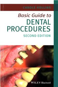 Basic Guide to Dental Procedures