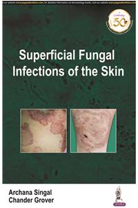 Superficial Fungal Infections of The Skin