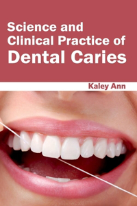 Science and Clinical Practice of Dental Caries