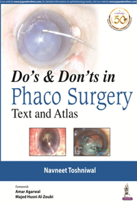 Do's & Don'ts In Phaco Surgery Text And Atlas