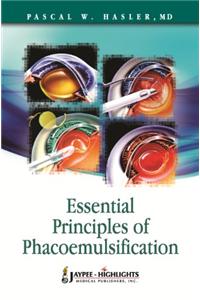 Essential Principles of Phacoemulsification