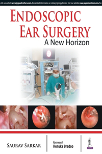 Endoscopic Ear Surgery