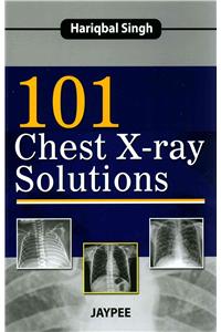 101 Chest X-Ray Solutions