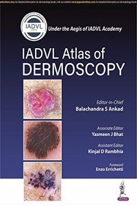 Atlas of Dermoscopy