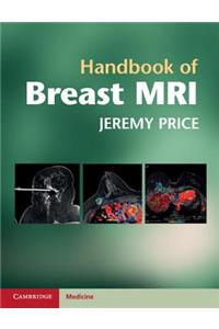 Handbook of Breast MRI