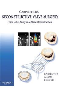 Carpentier's Reconstructive Valve Surgery