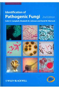 Identification of Pathogenic Fungi