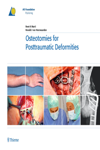 Osteotomies for Posttraumatic Deformities