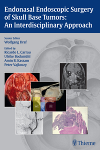 Endonasal Endoscopic Surgery of Skull Base Tumors: An Interdisciplinary Approach