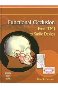 Functional Occlusion