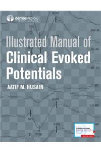 Illustrated Manual of Clinical Evoked Potentials