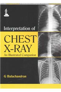 Interpretation of Chest X-Ray