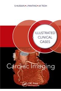 Cardiac Imaging