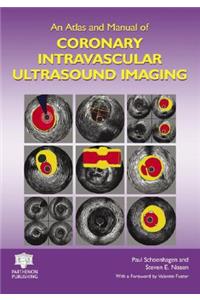 An Atlas and Manual of Coronary Intravascular Ultrasound Imaging