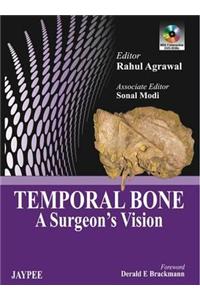 Temporal Bone